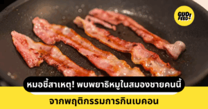 เบคอน