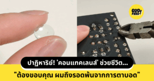 คอนแทคเลนส์